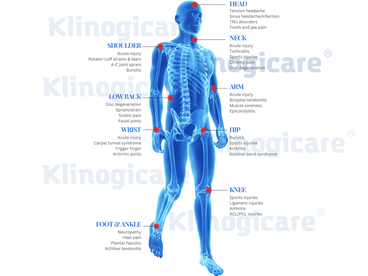 Atlante anatomico con le principali zone di applicazione della HILT: colonna vertebrale, grandi articolazioni, sistema nervoso periferico, muscoli, fasce, legamenti e tendini